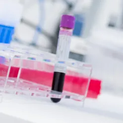 Et nærbilde av en handlekurv